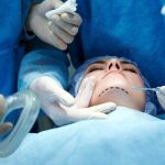سن انجام عمل های زیبایی کاهش پیدا کرده است