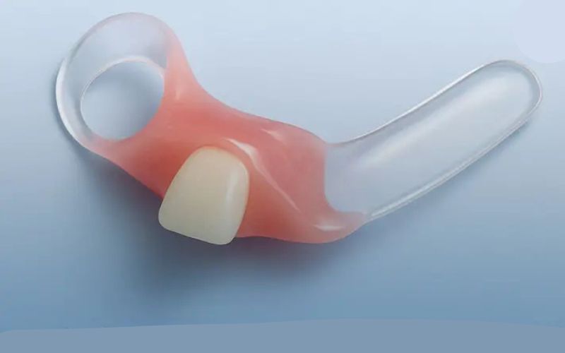 تفاوت فلیپر دندان با پروتز موقت؛ کدام گزینه برای شما مناسب‌تر است؟