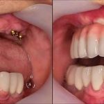 آینده دندانپزشکی: از درمان‌های سنتی تا فناوری‌های شگفت‌انگیز