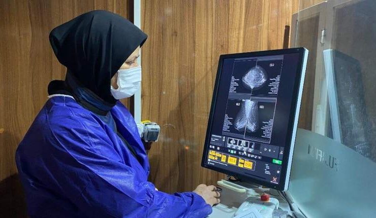 ماموگرافی رایگان زنان در سراسر کشور از 26 مهر تا 3 آبان ماه