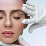 هزینه بلفاروپلاستی و عوامل اثر گذار بر هزینه جراحی پلک