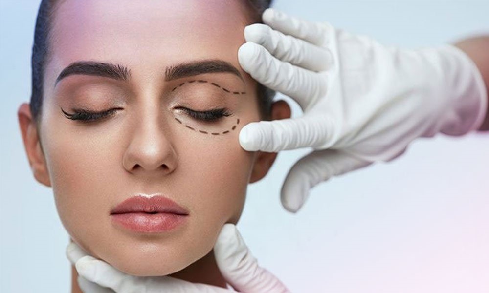 هزینه بلفاروپلاستی و عوامل اثر گذار بر هزینه جراحی پلک